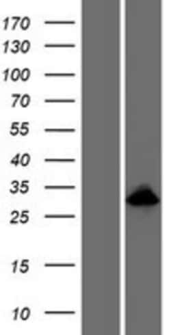 Novus Biologicals&trade;&nbsp;ODAM Overexpression Lysate