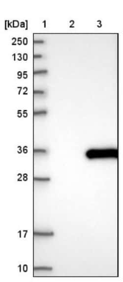 APIP Antibody, Novus Biologicals 0.1mL; Unlabeled:Antibodies, Polyclonal