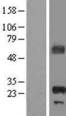 Novus Biologicals&trade;&nbsp;APIP Overexpression Lysate