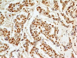 APIP Antibody (19F461), Novus Biologicals 0.025mg; Unlabeled:Antibodies,