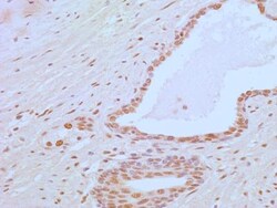 APIP Antibody (19F461), Novus Biologicals 0.025mg; Unlabeled:Antibodies,