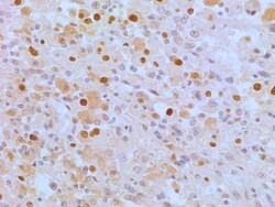 APIP Antibody (19F461), Novus Biologicals 0.025mg; Unlabeled:Antibodies,