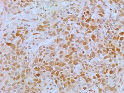 APIP Antibody (19F461), Novus Biologicals 0.025mg; Unlabeled:Antibodies,