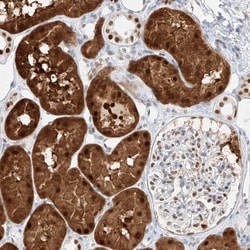 APIP Antibody, Novus Biologicals 0.1mL; Unlabeled:Antibodies, Polyclonal