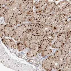 APIP Antibody, Novus Biologicals 0.1mL; Unlabeled:Antibodies, Polyclonal