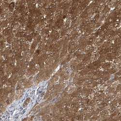 APLF Antibody, Novus Biologicals:Antibodies:Primary Antibodies