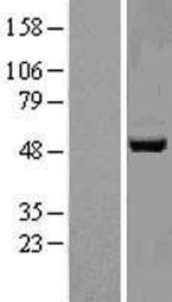 Novus Biologicals&trade;&nbsp;APMAP Overexpression Lysate