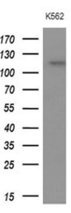 APOB48R Antibody (OTI1B1), Novus Biologicals 0.1mL; Unlabeled:Antibodies,