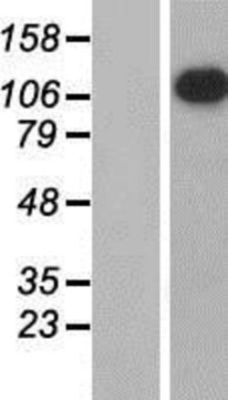 Novus Biologicals™ APOB48R Overexpression Lysate