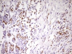 APOB48R Antibody (OTI1B1), Novus Biologicals 0.1mL; Unlabeled:Antibodies,