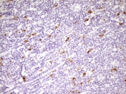 APOB48R Antibody (OTI1B1), Novus Biologicals 0.1mL; Unlabeled:Antibodies,