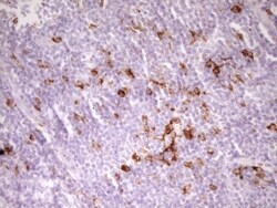 APOB48R Antibody (OTI1B1), Novus Biologicals 0.1mL; Unlabeled:Antibodies,