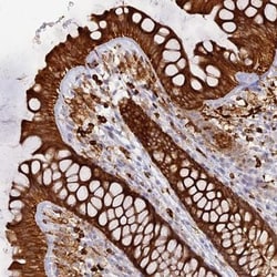 APOB48R Antibody, Novus Biologicals:Antibodies:Primary Antibodies