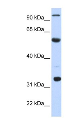 APOBEC1 Antibody, Novus Biologicals:Antibodies:Primary Antibodies
