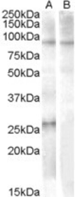 APOBEC2 Antibody, Novus Biologicals 0.1 mg | Buy Online | Novus Biologicals | Fisher Scientific
