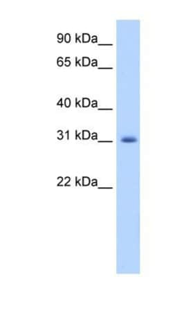 APOBEC2 Antibody, Novus Biologicals 20μL; Unlabeled:Antibodies, Polyclonal