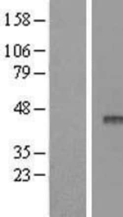 Novus Biologicals™ APOBEC3F Overexpression Lysate