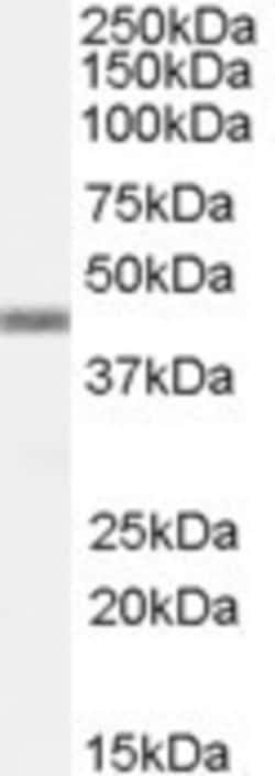 APOBEC3G Antibody, Novus Biologicals 0.1mg; Unlabeled:Antibodies, Polyclonal