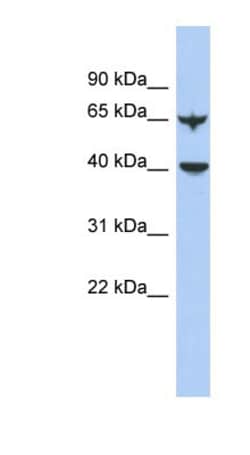 APOBEC4 Antibody, Novus Biologicals 100μL; Unlabeled:Antibodies, Polyclonal