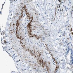 APOBEC4 Antibody, Novus Biologicals 0.1mL; Unlabeled:Antibodies, Polyclonal