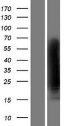 Novus Biologicals&trade;&nbsp;Clusterin/APOJ Overexpression Lysate