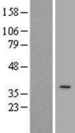 Novus Biologicals&trade;&nbsp;APOL3 Overexpression Lysate