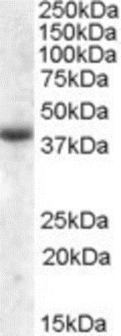 APOL6 Antibody, Novus Biologicals 0.1mg; Unlabeled:Antibodies, Polyclonal