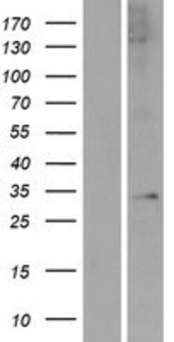 Novus Biologicals&trade;&nbsp;APOLD1 Overexpression Lysate