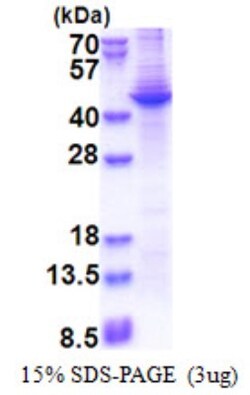 Novus Biologicals&trade;&nbsp;Recombinant Human Apolipoprotein A5 His Protein