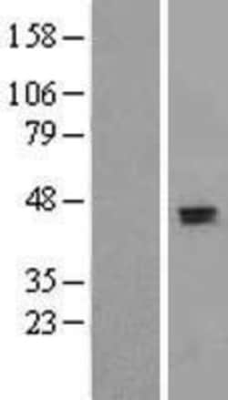 Novus Biologicals™ Apolipoprotein H/ApoH Overexpression Lysate