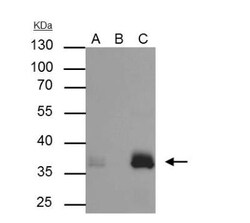 Apolipoprotein E/ApoE Antibody - BSA Free, Novus Biologicals 0.1 mg; Unconjugated:Antibodies,