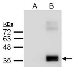 Apolipoprotein E/ApoE Antibody - BSA Free, Novus Biologicals 0.1 mg; Unconjugated:Antibodies,