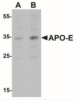 Apolipoprotein E/ApoE Antibody - BSA Free, Novus Biologicals:Antikörper:Primärantikörper
