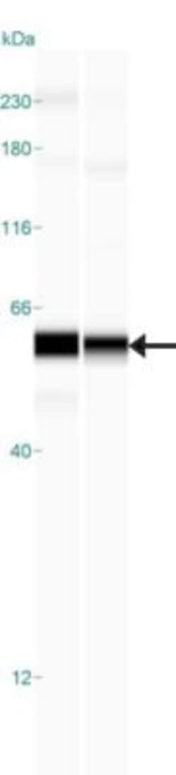 Apolipoprotein L1 Antibody, Novus Biologicals 25 &mu;L | Buy Online | Novus Biologicals | Fisher Scientific