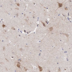 Apolipoprotein L2 Antibody, Novus Biologicals:Antibodies:Primary Antibodies