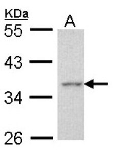 Apoptosis enhancing nuclease Antibody, Novus Biologicals 0.1mL; Unlabeled:Antibodies,