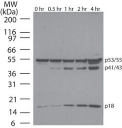 Novus Biologicals Apoptosis Detection Antibody Pack 3 vials:Antibodies