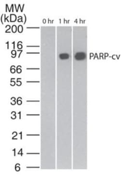 Novus Biologicals Apoptosis Detection Antibody Pack 3 vials:Antibodies