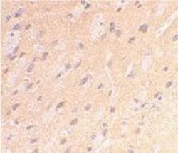 APP Antibody, Novus Biologicals 0.1 mg | Buy Online | Novus Biologicals | Fisher Scientific