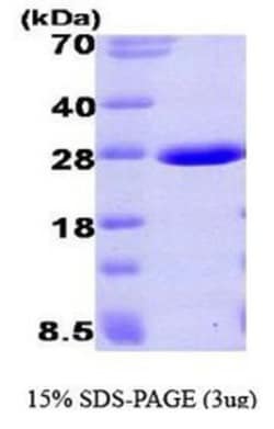 Novus Biologicals&trade;&nbsp;Recombinant Human Aprataxin His Protein