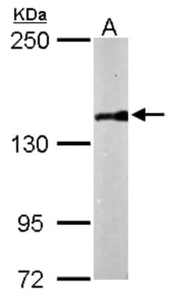 APRIN Antibody, Novus Biologicals 0.1mL; Unlabeled:Antibodies, Polyclonal