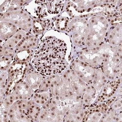 APRIN Antibody, Novus Biologicals:Antibodies:Primary Antibodies