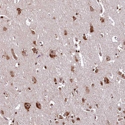 APRIN Antibody, Novus Biologicals 0.1mL; Unlabeled:Antibodies, Polyclonal