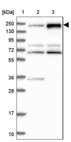 APRIN Antibody, Novus Biologicals 0.1mL; Unlabeled:Antibodies, Polyclonal