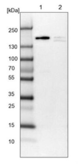 APRIN Antibody, Novus Biologicals 0.1mL; Unlabeled:Antibodies, Polyclonal