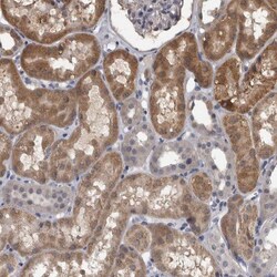 APRT Antibody, Novus Biologicals 0.1mL; Unlabeled:Antibodies, Polyclonal