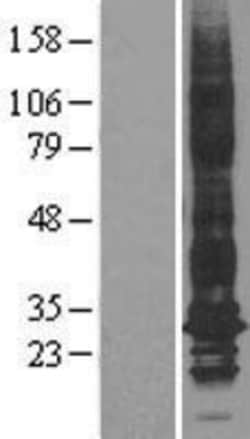 Novus Biologicals™ Aquaporin 1/AQP1 Overexpression Lysate
