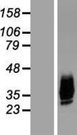 Novus Biologicals&trade;&nbsp;Aquaporin-10 Overexpression Lysate
