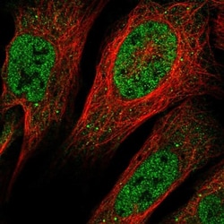 Aquaporin-11 Antibody, Novus Biologicals 0.1mL; Unlabeled:Antibodies, Polyclonal