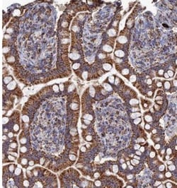 Aquaporin-11 Antibody, Novus Biologicals 0.1mL; Unlabeled:Antibodies, Polyclonal